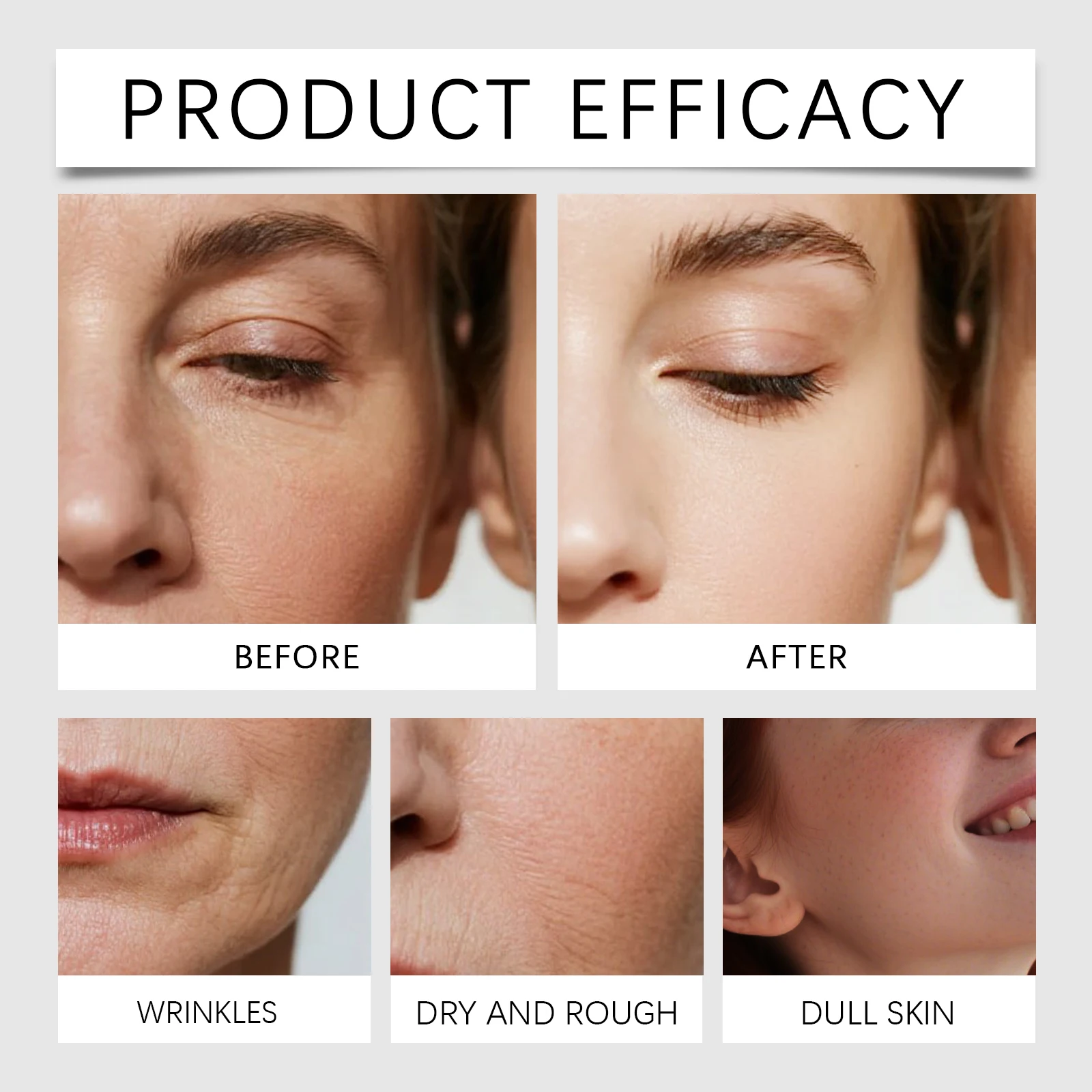 Sérum Micro-Aiguilles Réparate - Hyaluronic Acid Facial Serum avis et prix