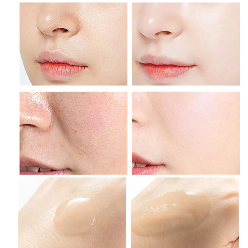 Sérum Peeling acide salicyliqu - Niacinamide Pore Shrinking Essence avis et prix